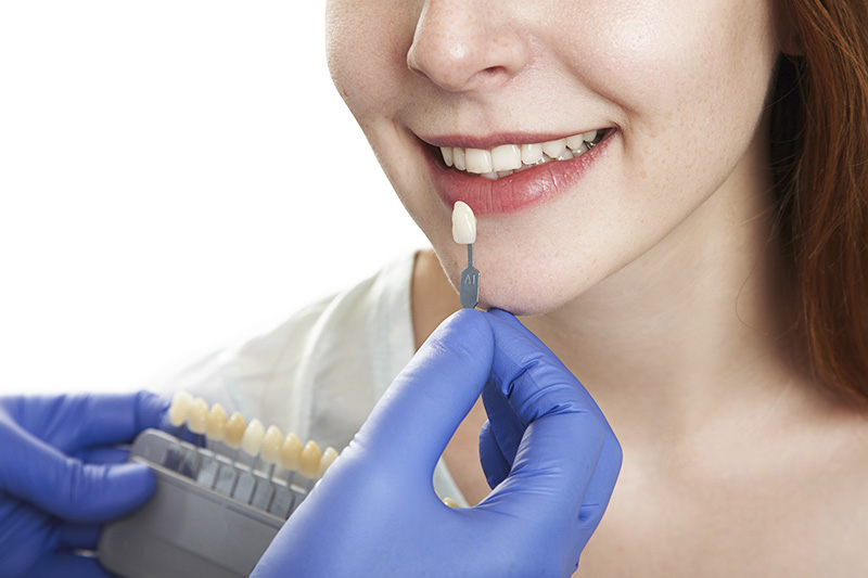 Licowe Zęby - licówki - Wrocław