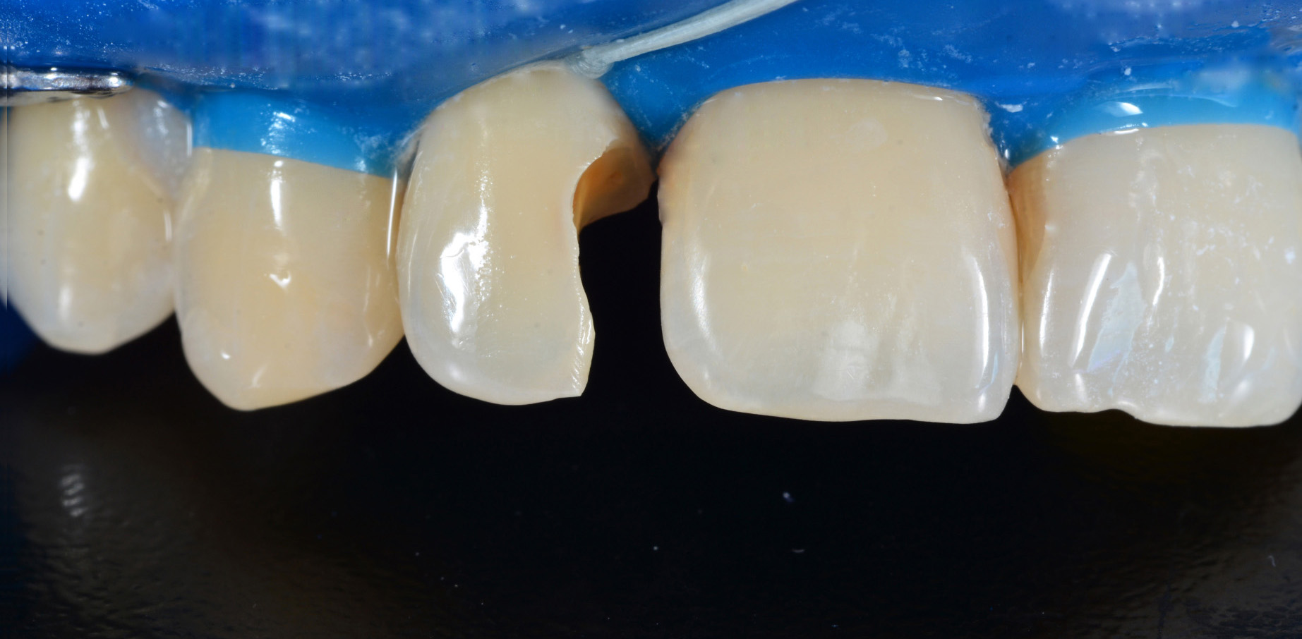 metamorfoza uśmiechu