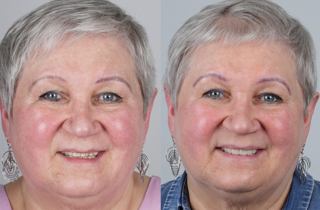 metamorfoza usmiechu klinika platinum wroclaw 2