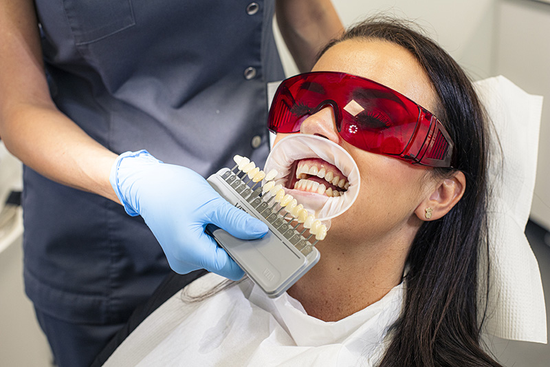 Wybielanie zębów Wrocław